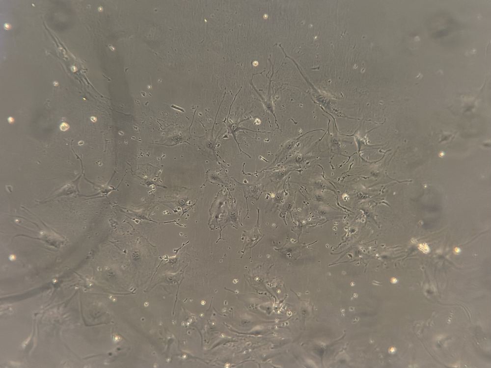 Microscope image of bEnd.3 brain endothelial cells